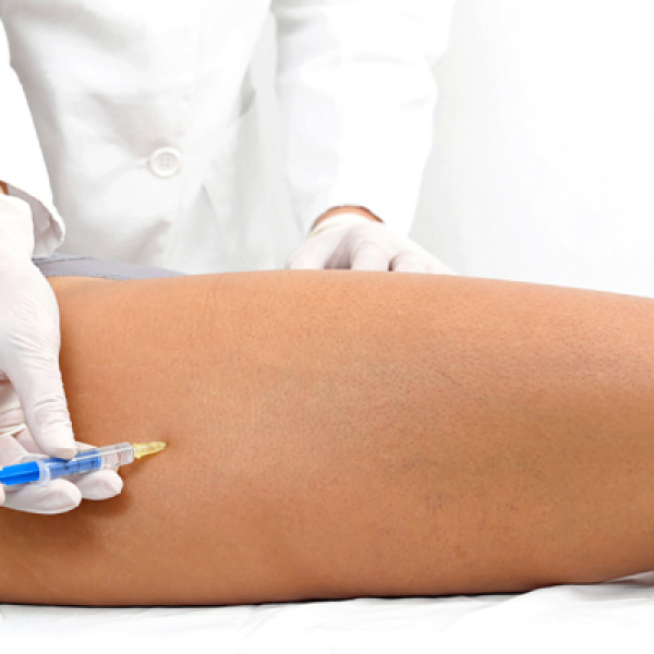 Mesoterapia controindicazioni