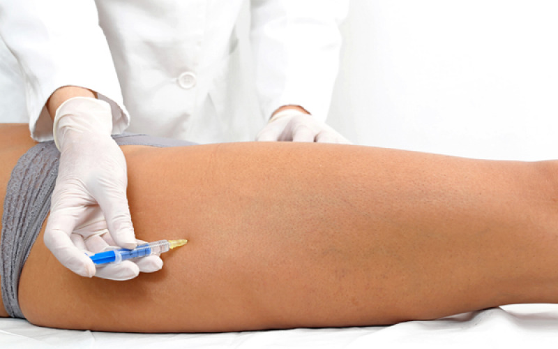 Mesoterapia controindicazioni