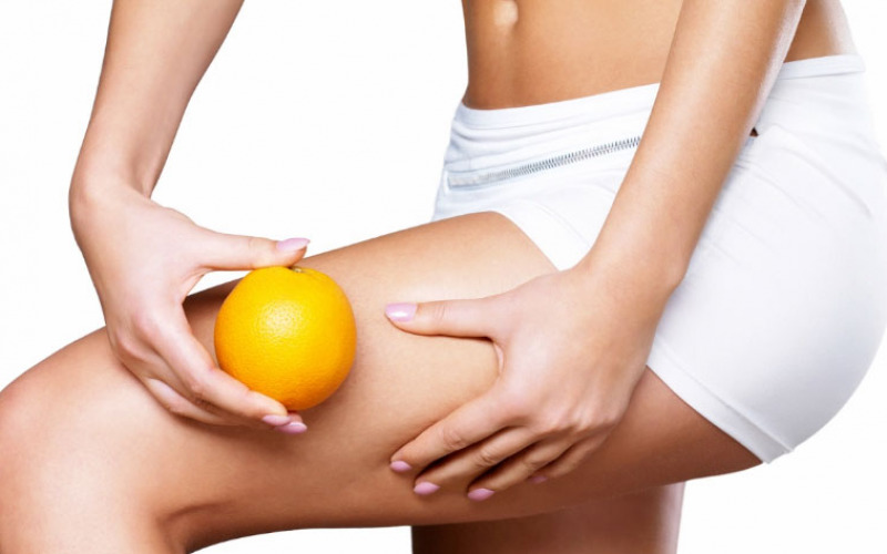 Cellulite come curarla