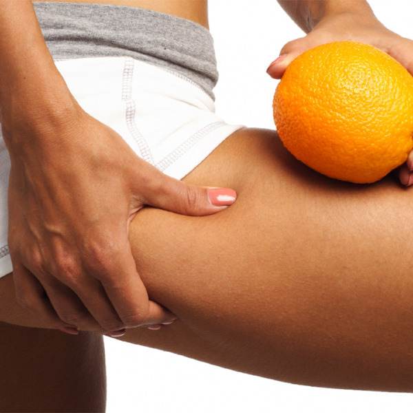 Alterazione strutturale e anatomia della cellulite